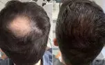 اسکلپ سر چیست؟ / بهترین و بدترین کارها برای سلامت اسکالپ 