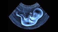 غربالگری جنین ممنوع نشده است / وزارت بهداشت تاکید کرد