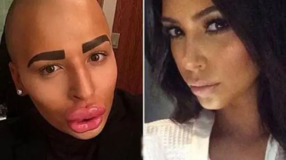 50 عمل جراحی یک پسر برای شبیه شدن به کیم کارداشیان + عکس 