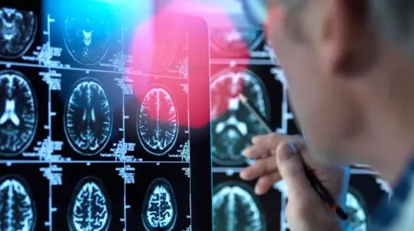 کشف دانشمندان: مغز انسان 5 «دوره» دارد / حالت بزرگسالی از اوایل دهه 30 آغاز می‌شود