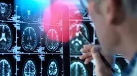 کشف دانشمندان: مغز انسان 5 «دوره» دارد / حالت بزرگسالی از اوایل دهه 30 آغاز می‌شود