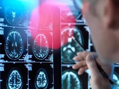 کشف دانشمندان: مغز انسان 5 «دوره» دارد / حالت بزرگسالی از اوایل دهه 30 آغاز می‌شود