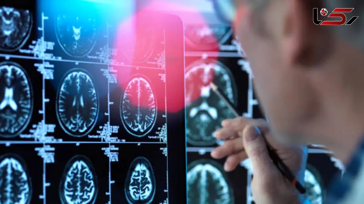 کشف دانشمندان: مغز انسان 5 «دوره» دارد / حالت بزرگسالی از اوایل دهه 30 آغاز می‌شود