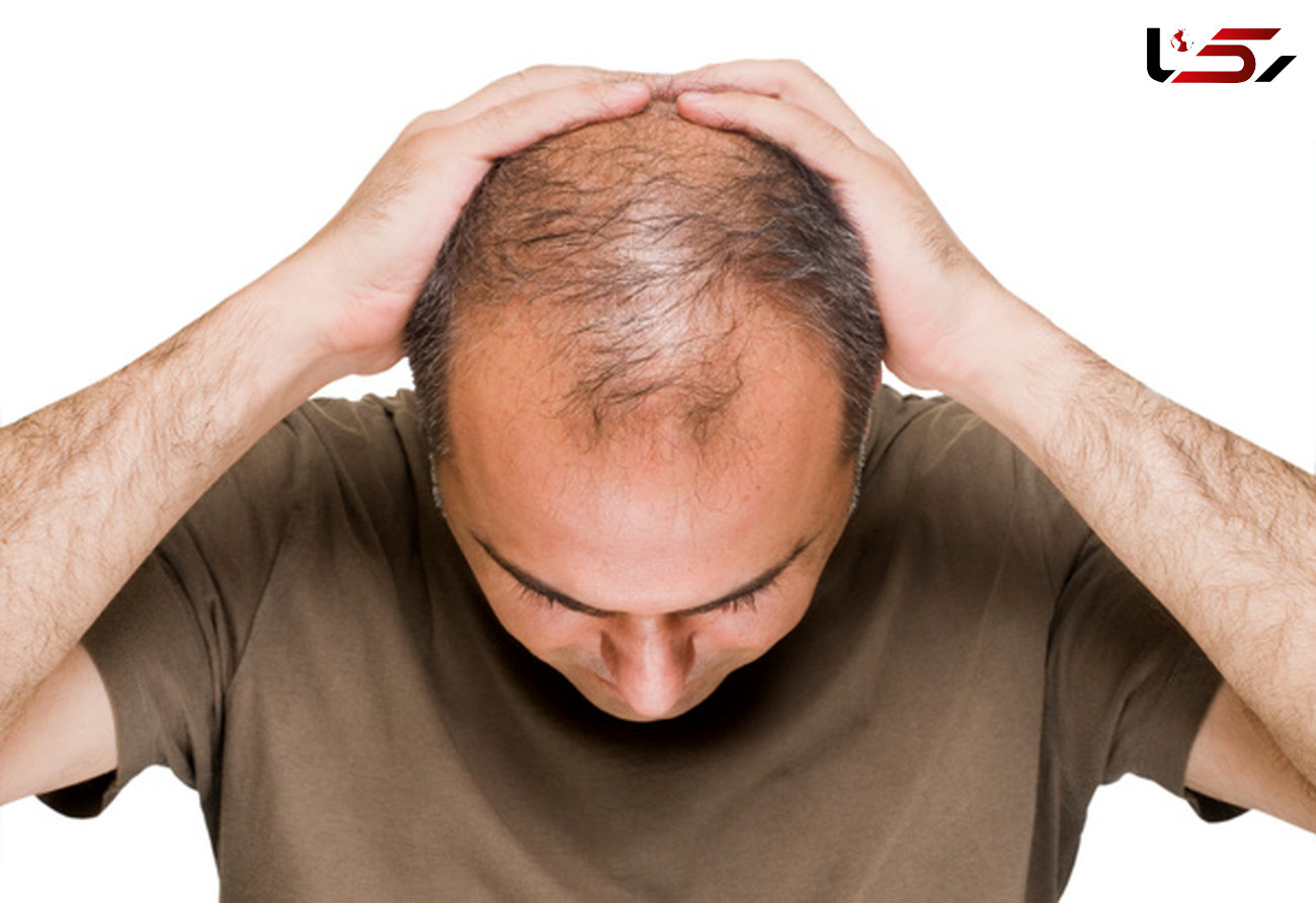 با 9 ترفند سریع الاثر ریزش مو را متوقف و درمان کنید 