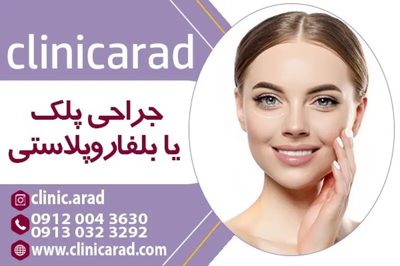 جراحی پف چشم