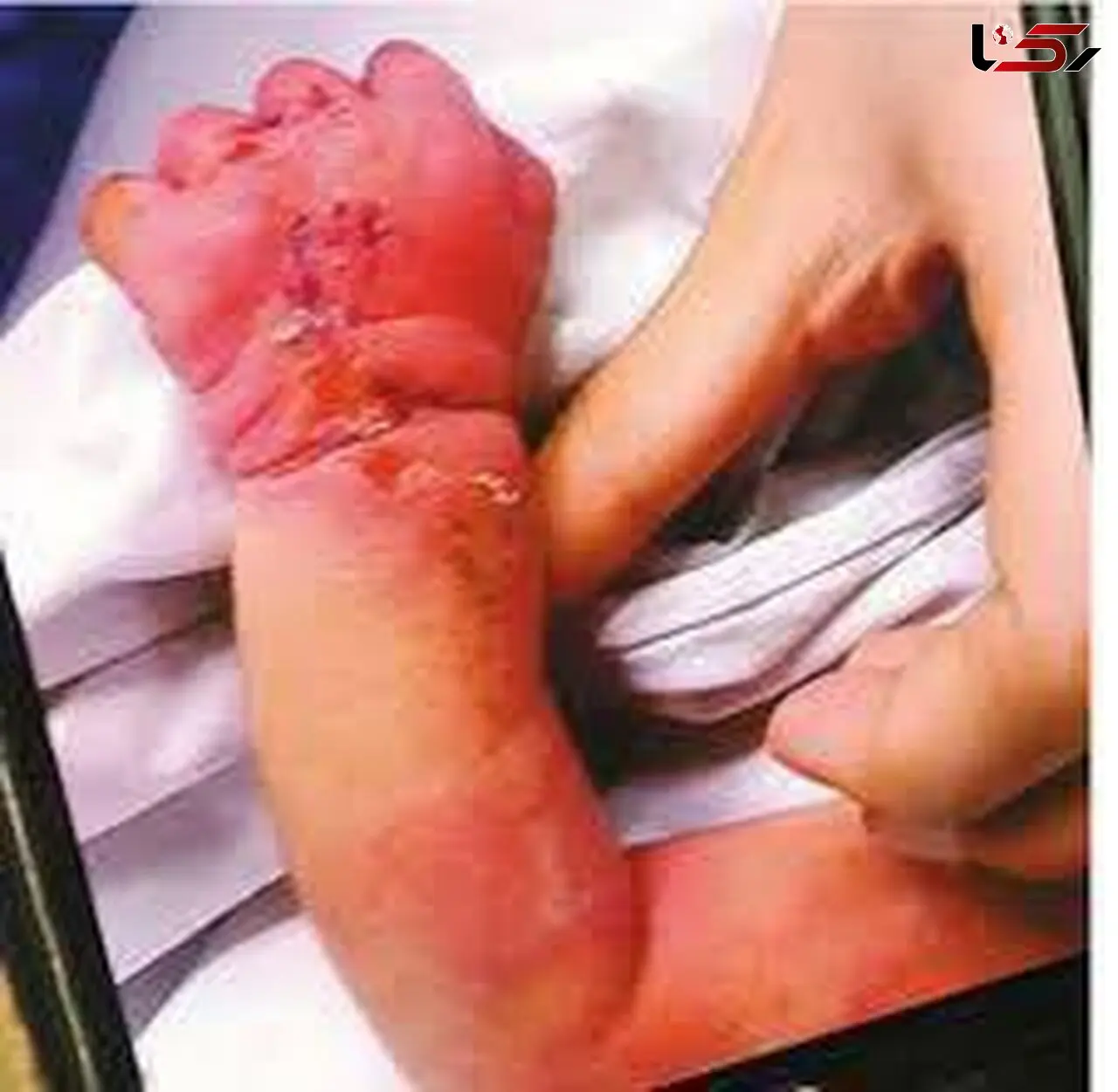 حادثه وحشتناکی که در اتاق یک زن بیمار در بیمارستان رخ داد + عکس