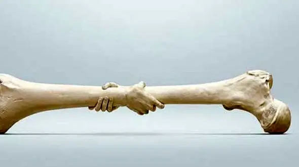 پوکی استخوان چیست؟ + غذاهای ضد پوکی استخوان