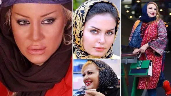 این خانم بازیگران ایرانی آخر جراحی پلاستیک هستند ! / زیبایی های پوشالی !