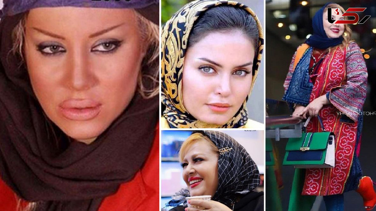 این خانم بازیگران ایرانی آخر جراحی پلاستیک هستند ! / زیبایی های پوشالی !