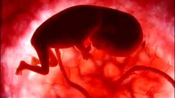 افزایش 30درصدی ذخیره سازی بند ناف در ایران / راهی برای درمان 80 بیماری لاعلاج