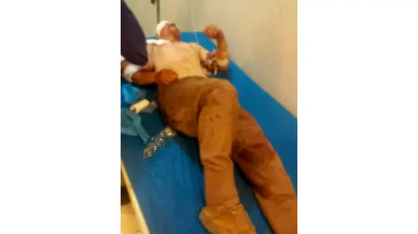 حمله خونین خرس قهوه ای به یک جوان / در ایذه رخ داد + عکس