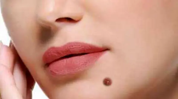 آیا همه خال ها را می شود برای نمونه برداری برداشت؟