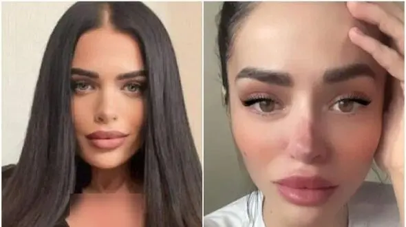 سلبریتی که با جراحی زیبایی زشت شد + عکس

