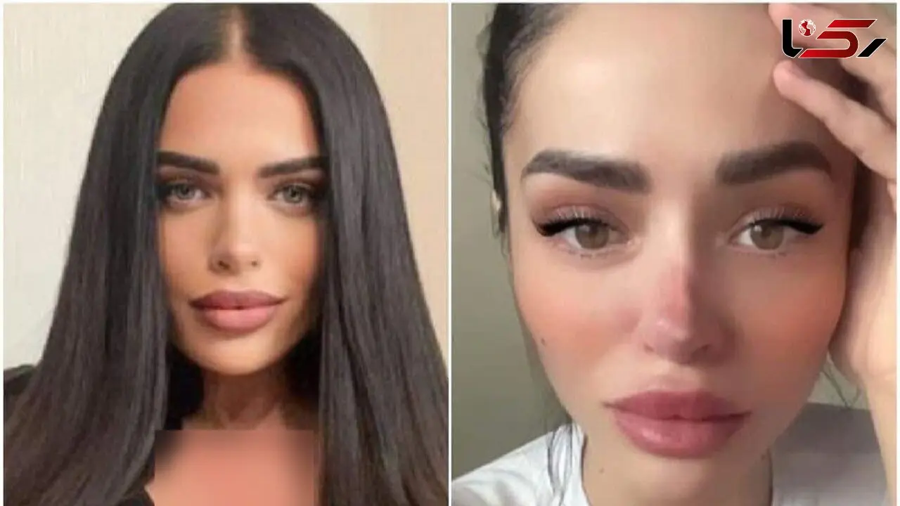 سلبریتی که با جراحی زیبایی زشت شد + عکس
