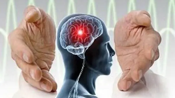 سکته مغزی با کم آبی بدن در ارتباط است