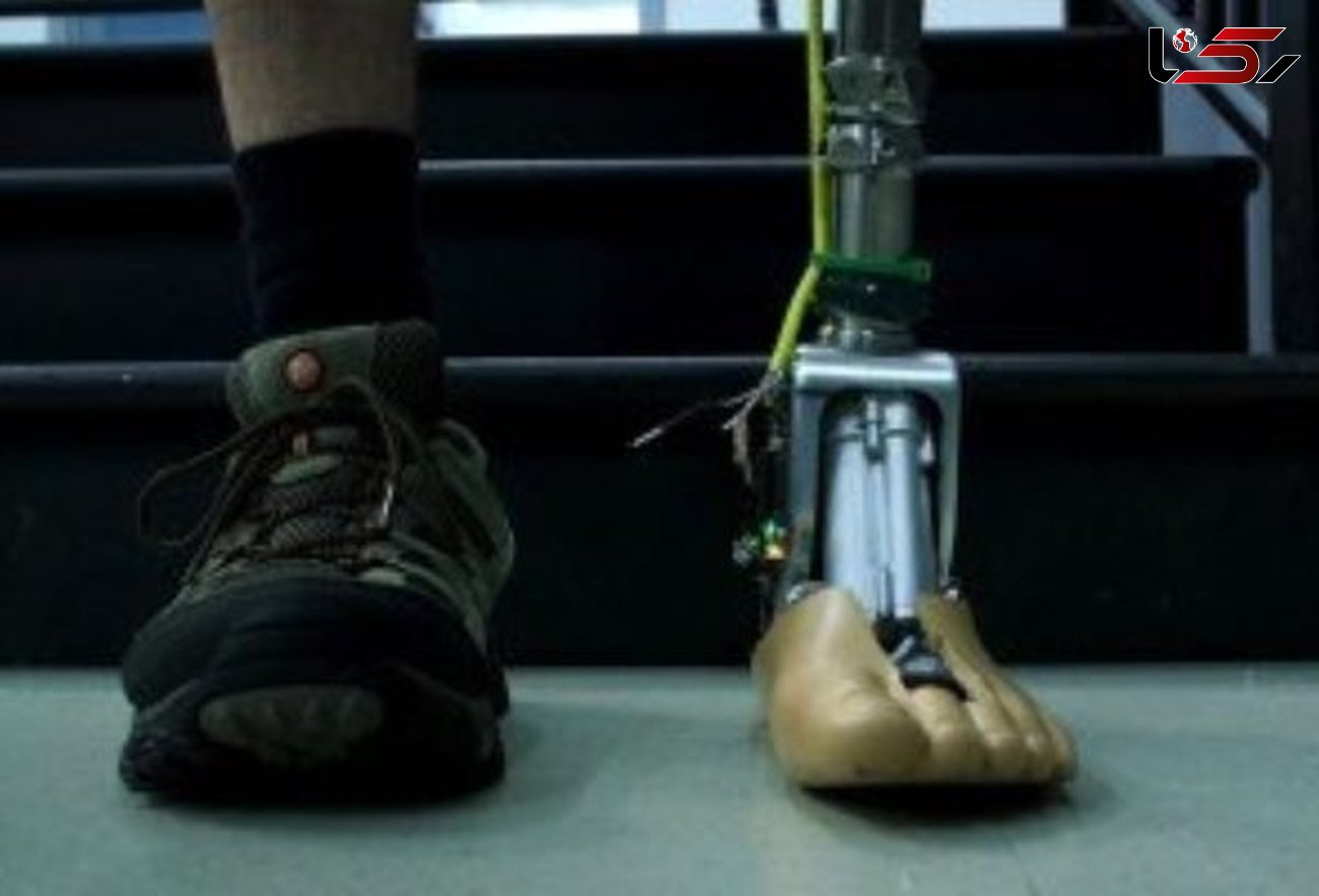طراحی پروتز هوشمند پا 
