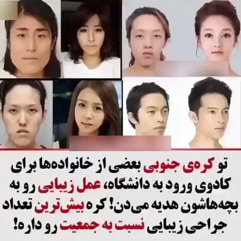 عمل زیبایی کره 
