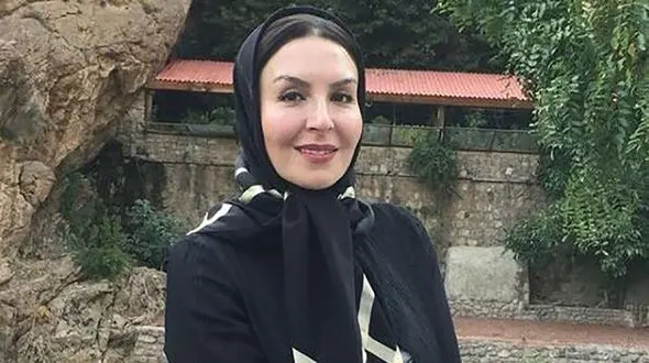 عکس زیرورو شدن صورت خانم بازیگر گاندو / آزیتا ترکاشوند را محاله بشناسید !