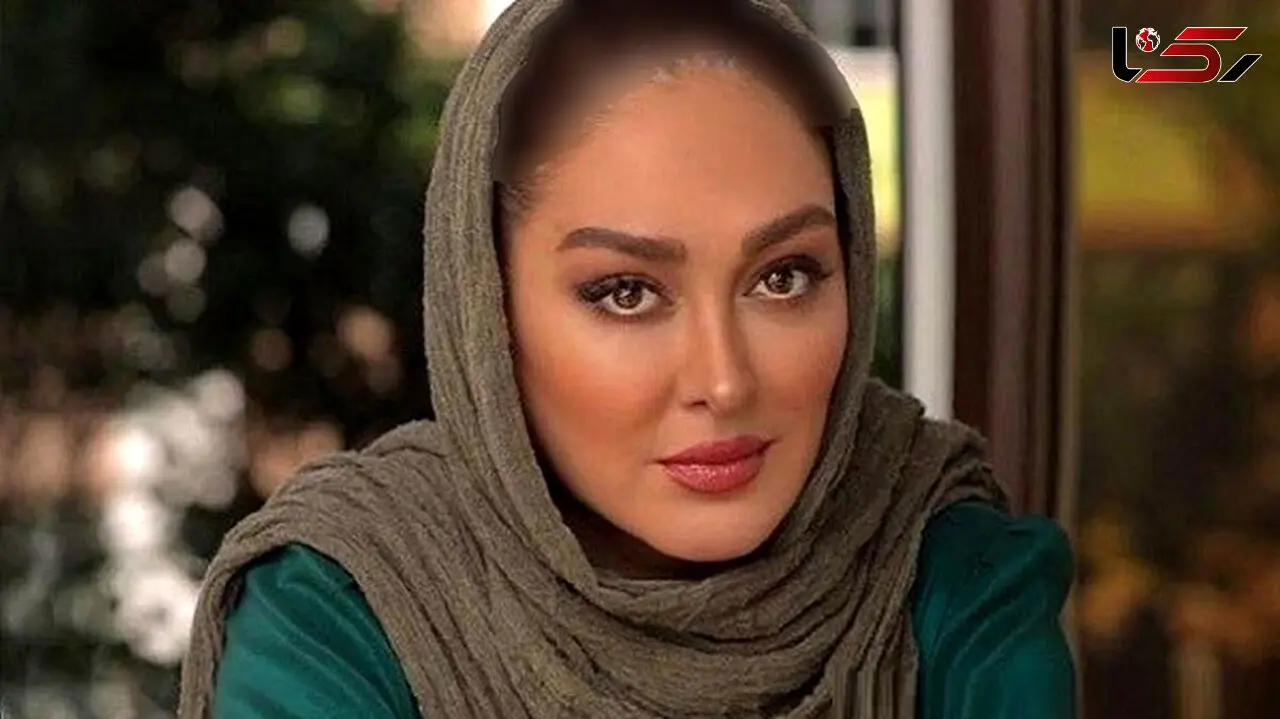 تغییرات همه صورت الهام حمیدی / شوکه کننده اما فوق جذاب! + 9 عکس بلوا کننده و هوش پران!