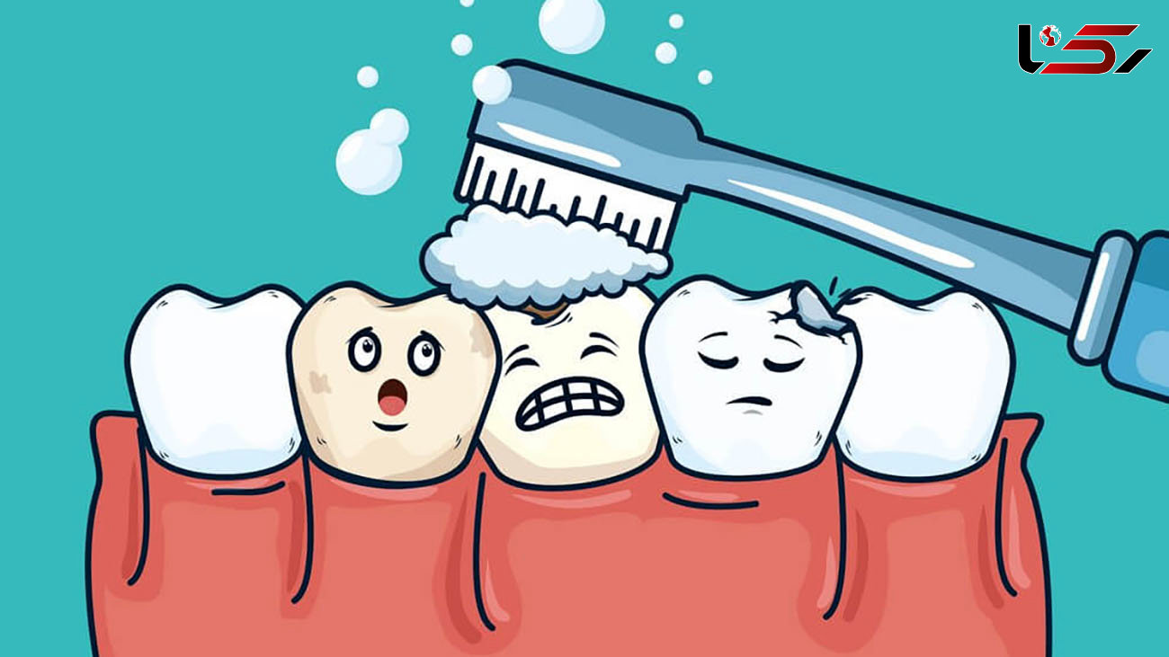 ارتباط بیماری‌ های دهان با سرطان‌ / آغاز کمپین «دهان دریچه سلامتی»