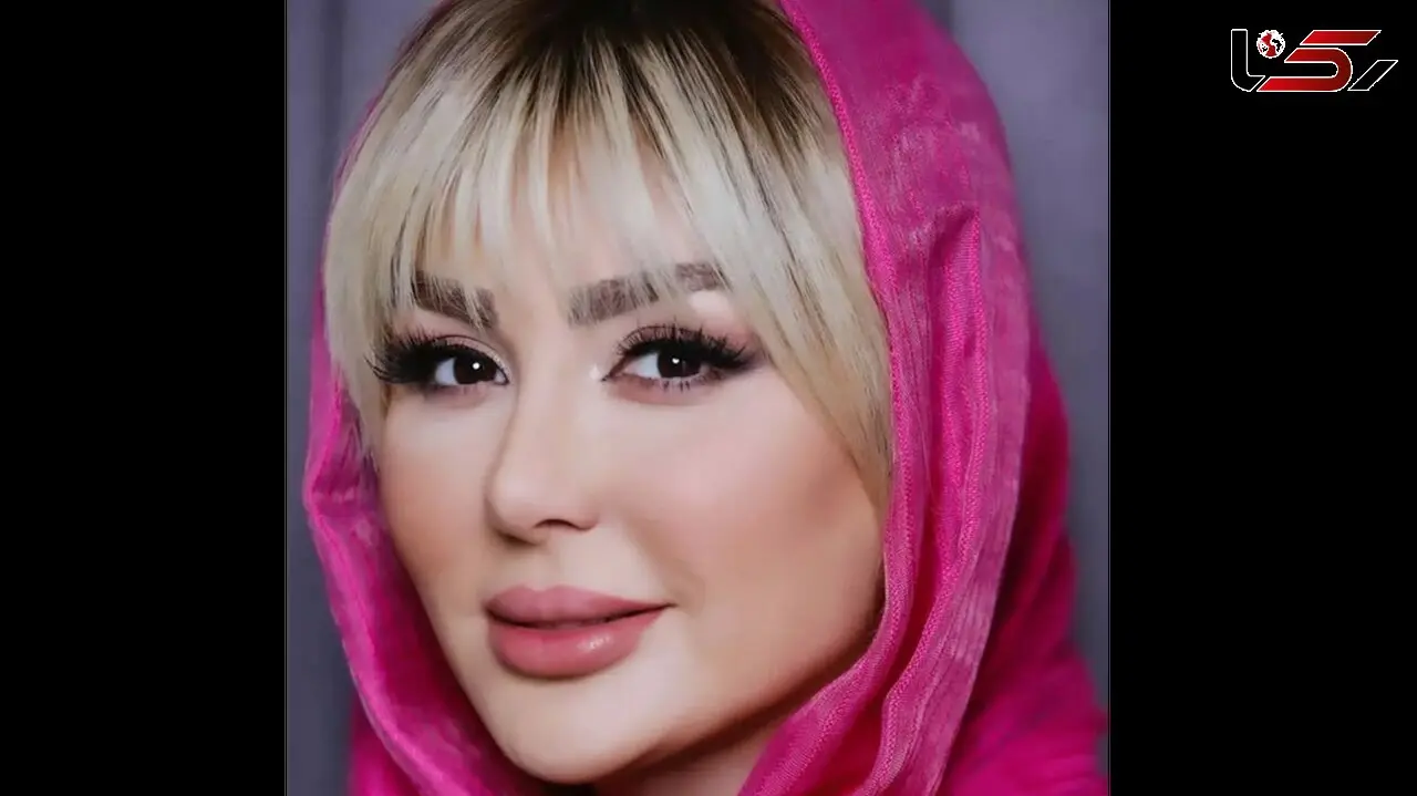 فیلم زیبایی مصنوعی نیوشا ضیغمی در جشن تولدش ! / چهره پر از ژلش را نمی شناسید !