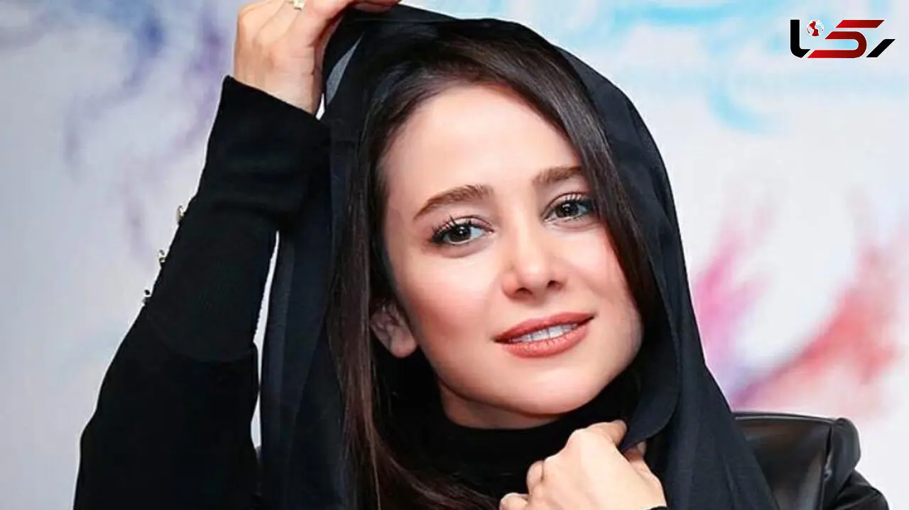 چهره باورنکردنی الناز حبیبی قبل از عمل زیبایی! +عکس 