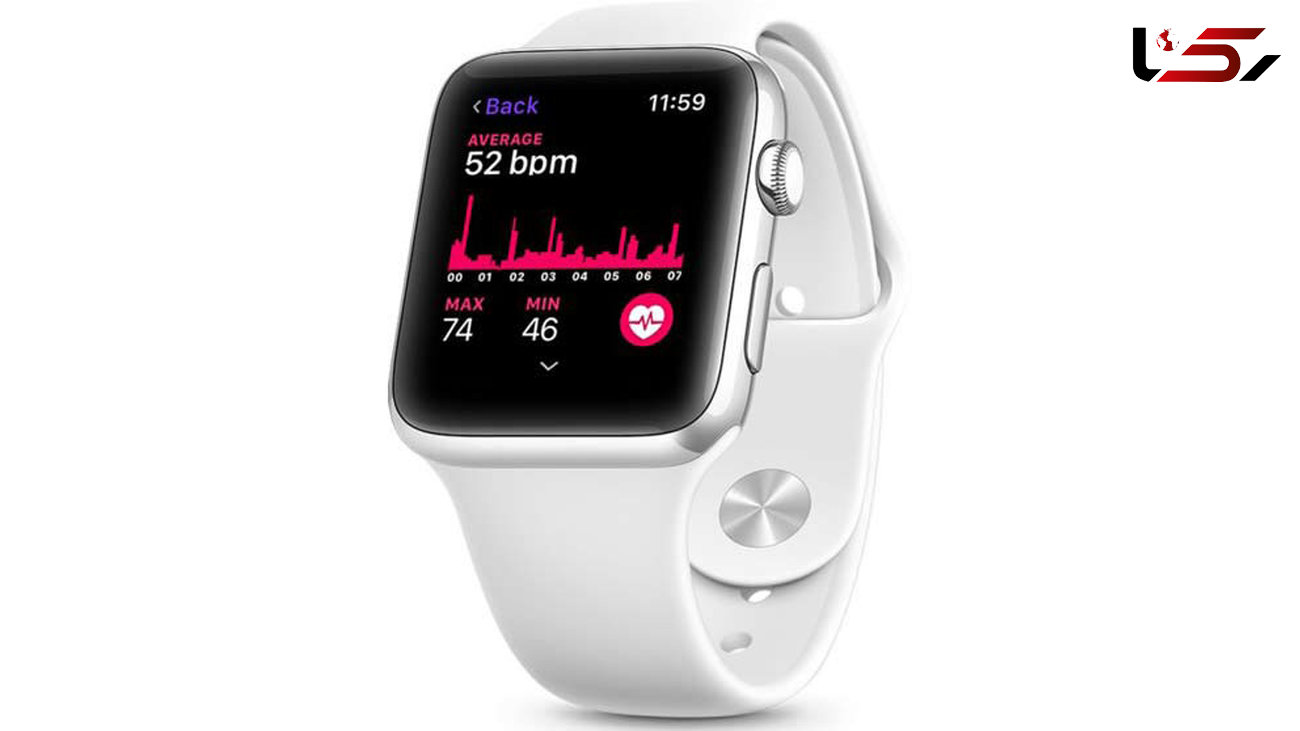 تشخیص بیماری قلبی با ساعت هوشمند اپل 