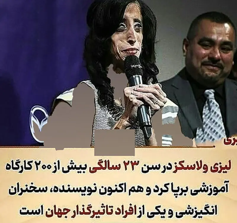 زشت ترین دختر جهان