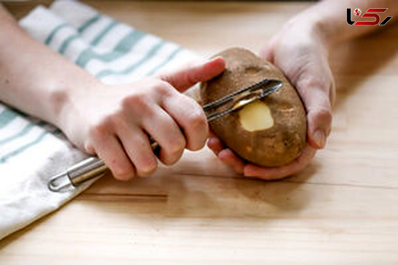درمان سنگ کلیه با پوست سیب زمینی