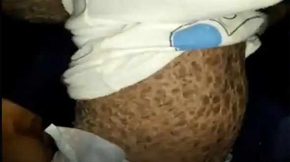 این کودک ایرانی در حال سنگ شدن است/ پزشکان به کمک بشتابند + فیلم 