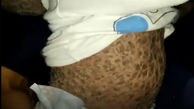 این کودک ایرانی در حال سنگ شدن است/ پزشکان به کمک بشتابند + فیلم 
