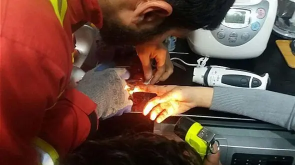  گوشت‌کوب برقی  انگشت دختر جوان را پس نداد + عکس 