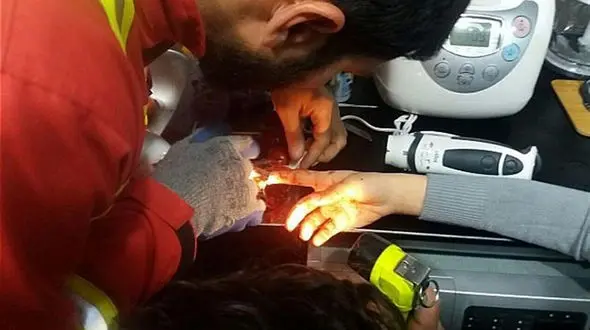  گوشت‌کوب برقی  انگشت دختر جوان را پس نداد + عکس 