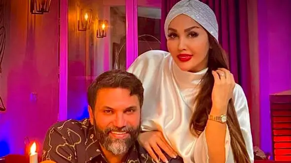 عکس باورنکردنی از چهره همسر نیکبخت واحدی قبل از عمل زیبایی ! / چه پلنگی بود !