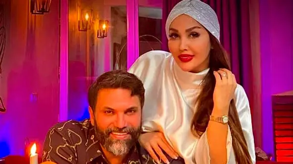 عکس باورنکردنی از چهره همسر نیکبخت واحدی قبل از عمل زیبایی ! / چه پلنگی بود !