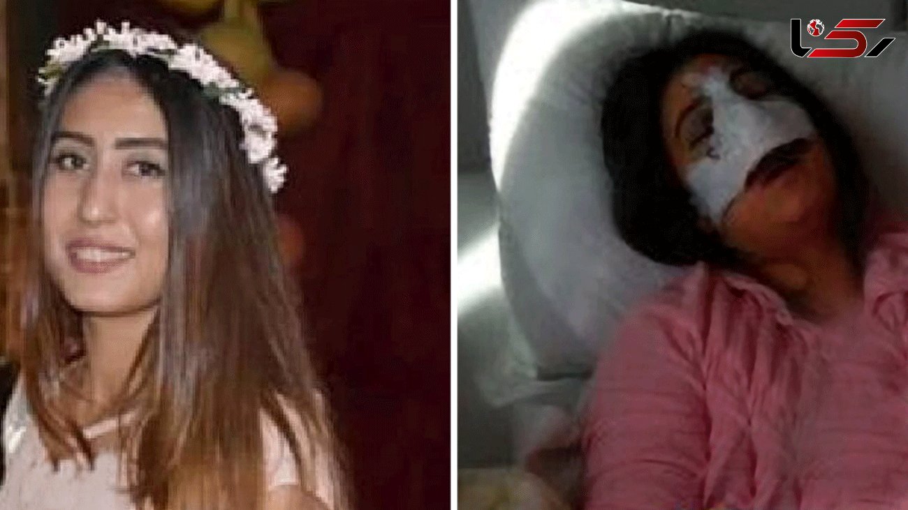Young woman dies of multiple organ failure 'caused by a nose job gone wrong'