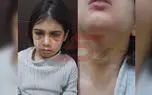 کودک آزاری آنیلا کوچولو  توسط نامادری اش ! / معلم و ناظم مدرسه افشا کردند / مادر دخترک سنندجی زود آسمانی شده بود ! + فیلم