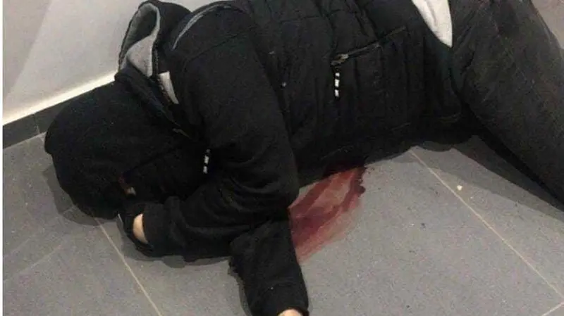 بلای هولناکی که بر سر نانسی عجرم در یک حمله مسلحانه آمد