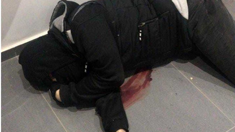 بلای هولناکی که بر سر نانسی عجرم در یک حمله مسلحانه آمد