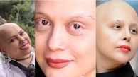 این ۳ خانم بازیگر ایرانی سرطان دارند ! / دعایشان کنید + عکس هاو اسامی
