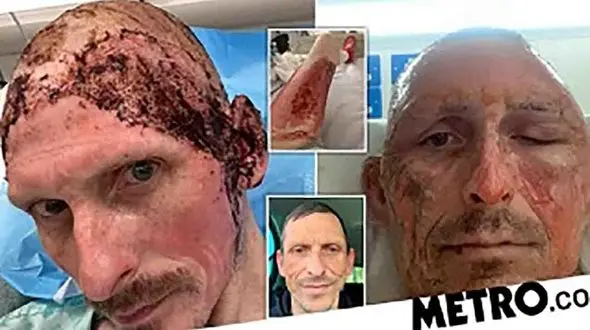 بلای وحشتناکی که بر سر راننده تاکسی آمد + عکس 16+