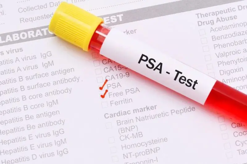 psa در آزمایش خون