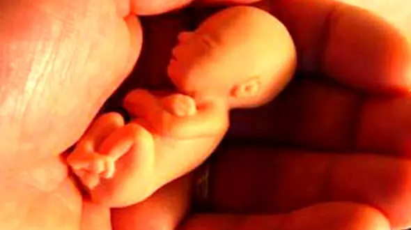 شکایت مرد تهرانی از همسرش بخاطر سقط جنین / آنها در یک قدمی جدایی بودند