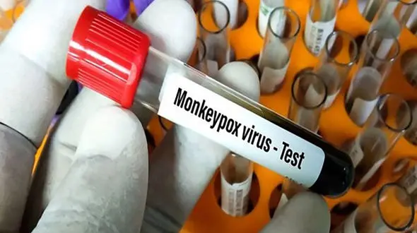 شناسایی فرد مشکوک به  آبله میمون در بابل + فیلم