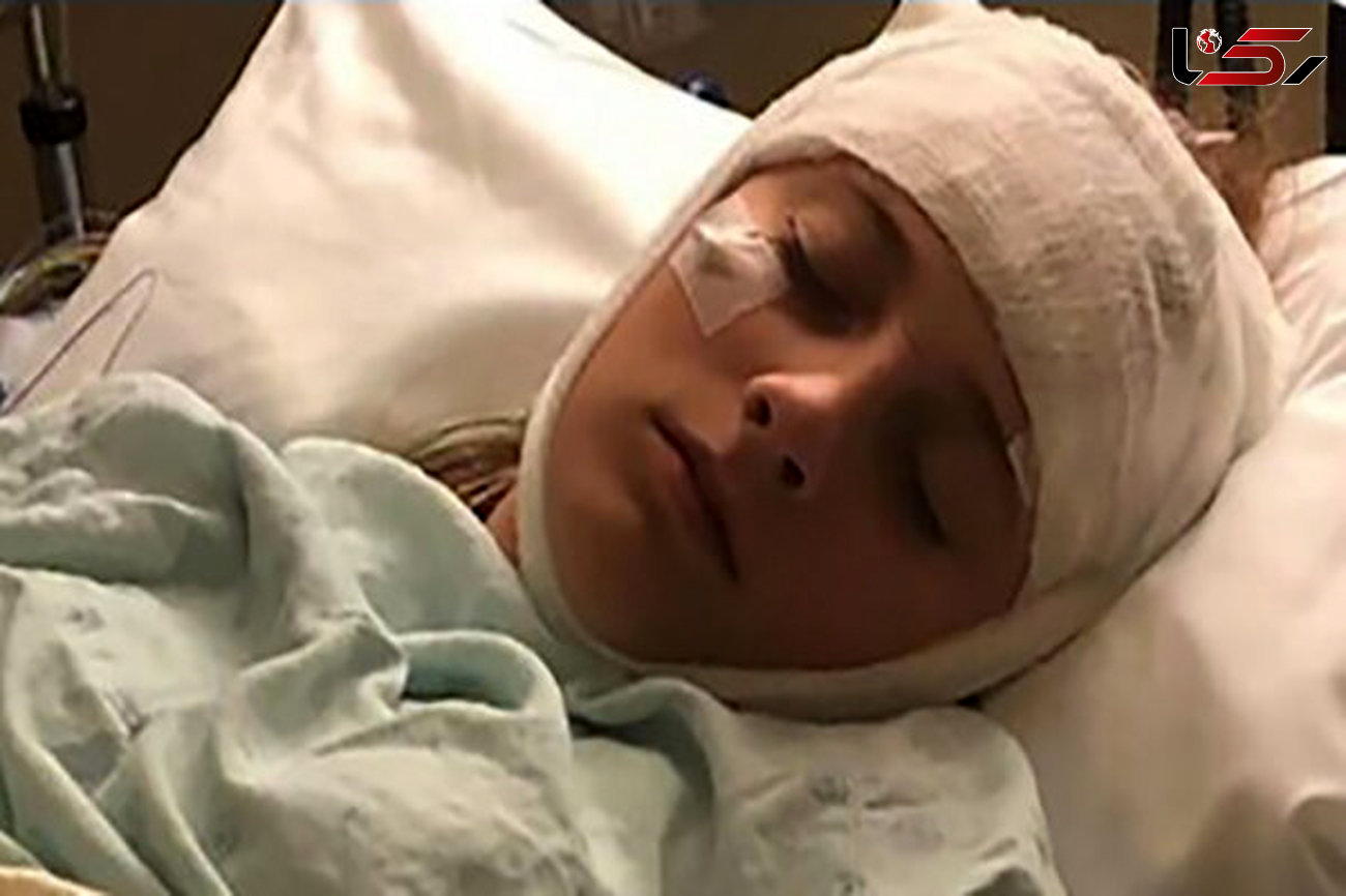 اتفاق وحشتناک برای  دختر نوجوان در پارتی شبانه! / پزشکان امریکایی باور نمی کنند! + عکس
