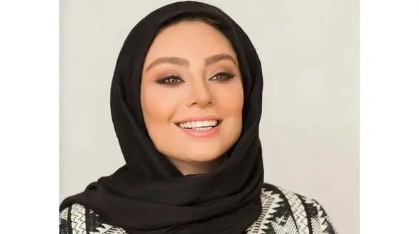 زشتی نامتعارف خانم بازیگر ایرانی با این عمل زیبایی / یکتا ناصر چرا اینجوری شد ؟!
