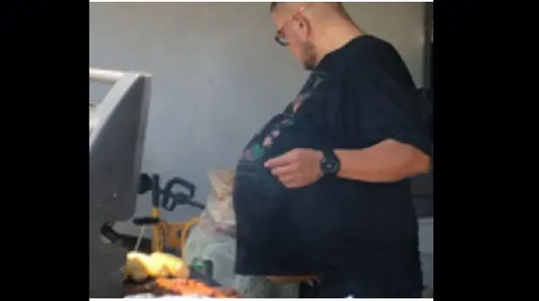 غده 34 کیلویی از شکم مرد 47 ساله خارج شد!+عکس