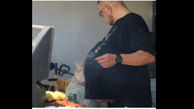 غده 34 کیلویی از شکم مرد 47 ساله خارج شد!+عکس