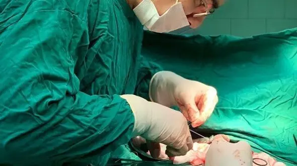 انجام عمل جراحی همی کولکتومی راست (برداشت روده بزرگ) اورژانسی در نوزاد ۵ ماهه در پارس آبادمغان