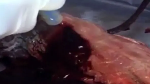 اختراعی برای جلوگیری فوری از خونریزی + فیلم